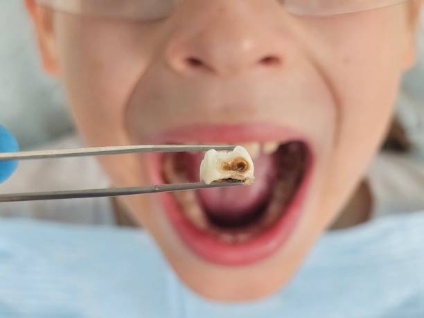Best Emergency Broken Tooth Repair in Black Mountain, NC